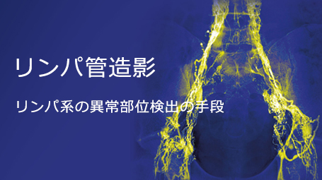 リンパ管造影について 画像下治療領域 Guerbet E Professionals 医療関係者サイト